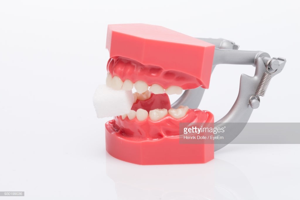 Balanced Occlusion In Complete Dentures Turner ME 4282